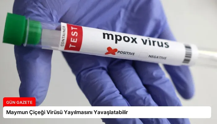 Maymun Çiçeği Virüsü Yayılmasını Yavaşlatabilir