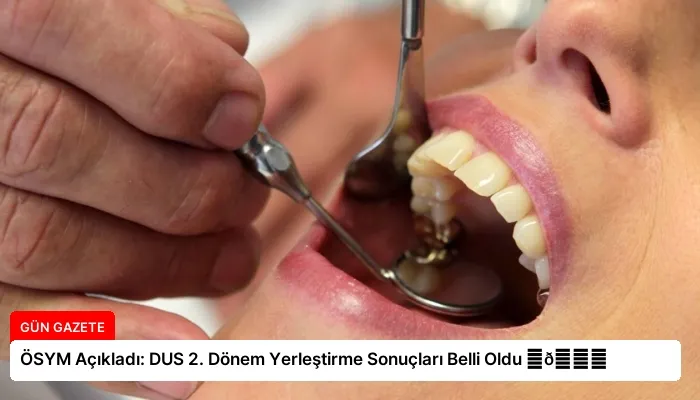 ÖSYM Açıkladı: DUS 2. Dönem Yerleştirme Sonuçları Belli Oldu ⏬👇